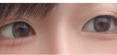 レビュー写真