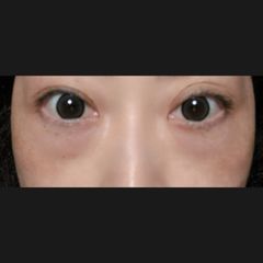 レビュー写真