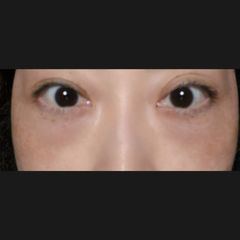 レビュー写真