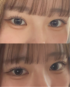 レビュー写真