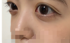 レビュー写真
