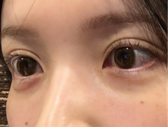 レビュー写真