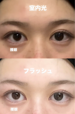 レビュー写真
