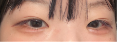 レビュー写真