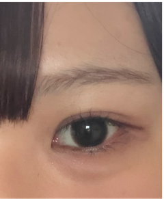 レビュー写真