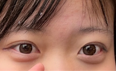レビュー写真