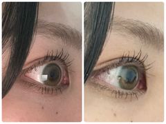 レビュー写真